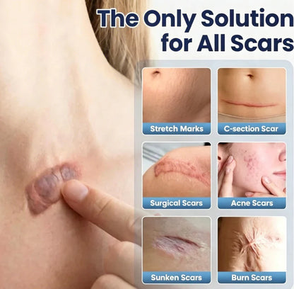 50% OFF + BUY 1 GET 1 FREE ✨ LIMITED OFFER 🔥 Advanced Scar Repair Cream💎