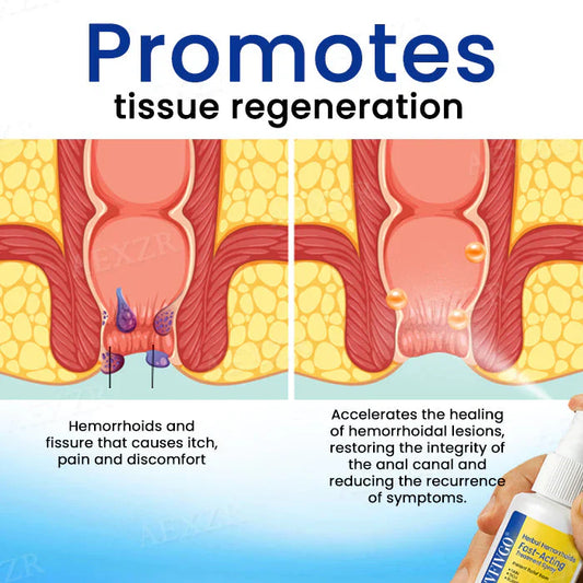 🔥Hot Sale 50% Off 🌿Herbal Hemorrhoids Fast-Acting Treatment Spray - 7 Days to a Happy , pain-Free 🔥 BUY 1 GET 1 FREE! 🔥