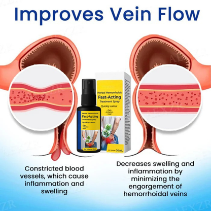 🔥Hot Sale 50% Off 🌿Herbal Hemorrhoids Fast-Acting Treatment Spray - 7 Days to a Happy , pain-Free 🔥 BUY 1 GET 1 FREE! 🔥