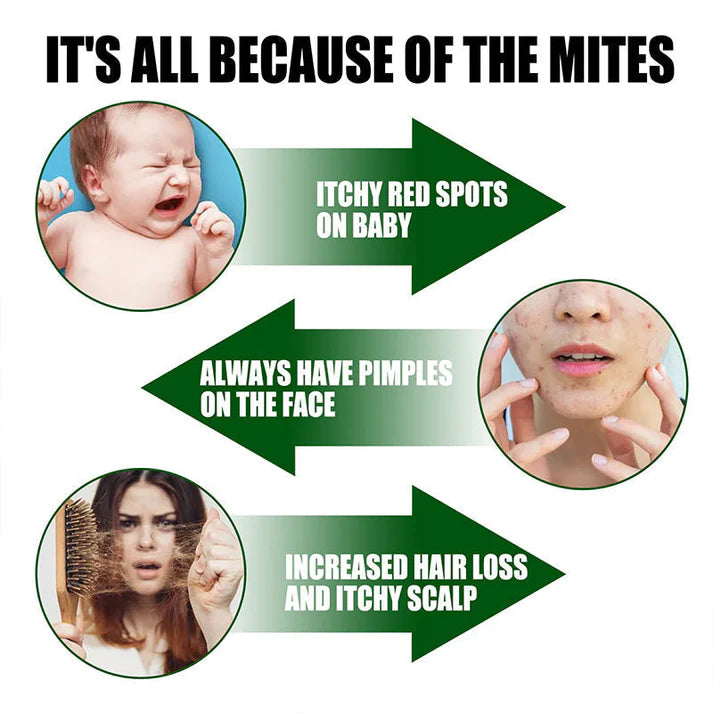 🔥 buy 1 get 1 free! 🔥powerful mite remover spray🔥